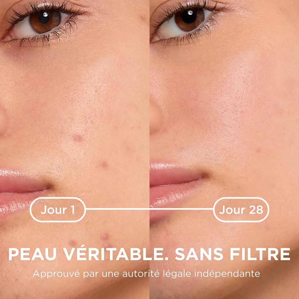 Bioderma Sébium Kérato+ — Gel-Crème Anti-Imperfections – Image 4