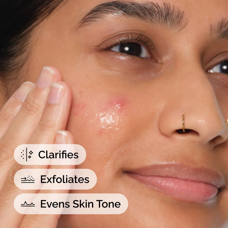 The Ordinary Solution Anhydre à l'Acide Salicylique 2% – Image 2