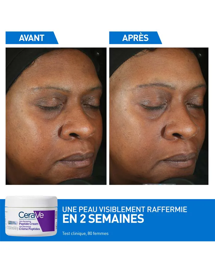 CeraVe Skin Renewing Crème Peptides – Image 4