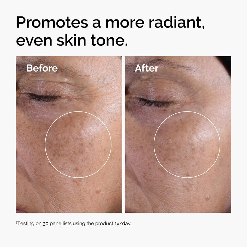 The Ordinary Tonique Exfoliant à l'Acide Glycolique 7% – Image 4