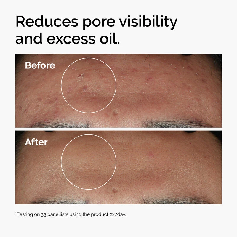 The Ordinary Niacinamide 10% + Zinc 1% – Image 3